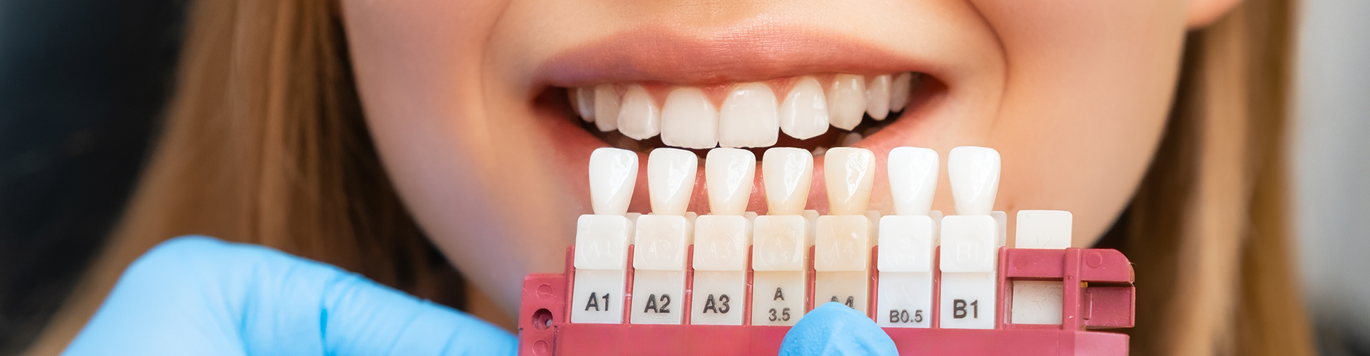 gloved hands holding tooth shade-matching tool against woman's smile