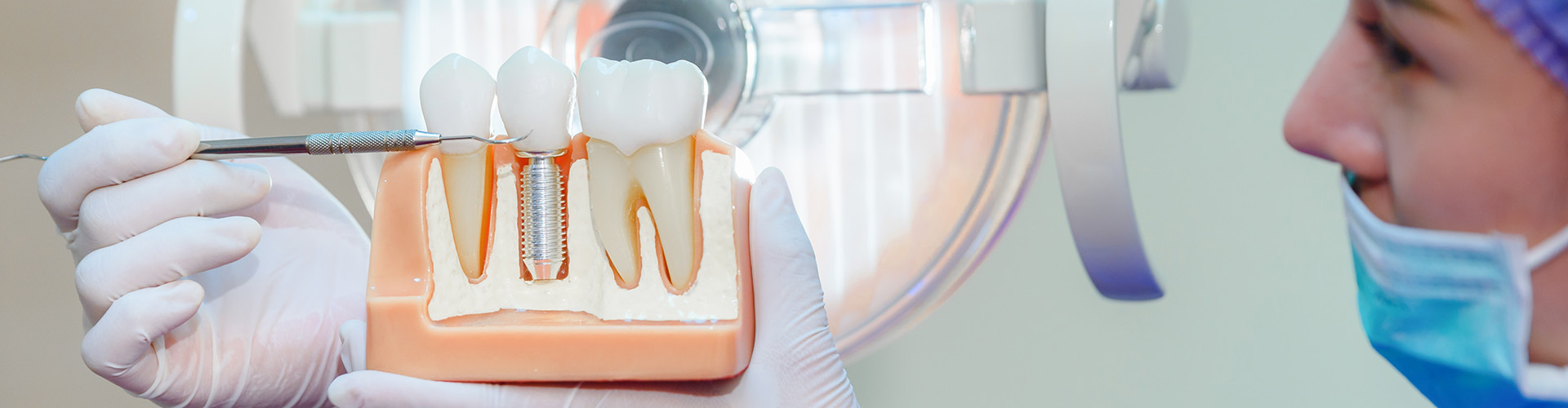 dentist holding a model of a dental implant between teeth