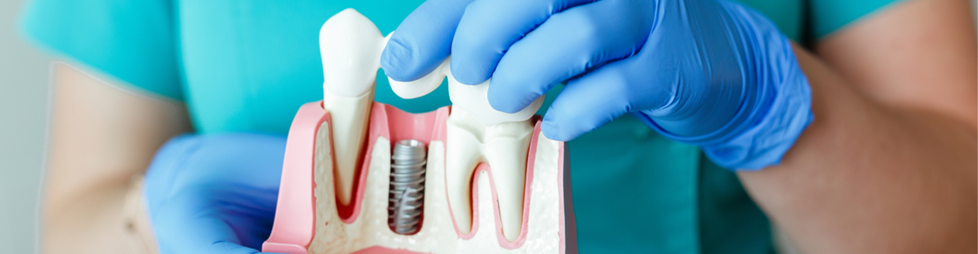 plastic demo of teeth and one with a screw
