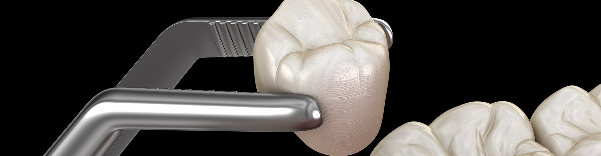 rendering of tweezers placing a dental crown in a jaw