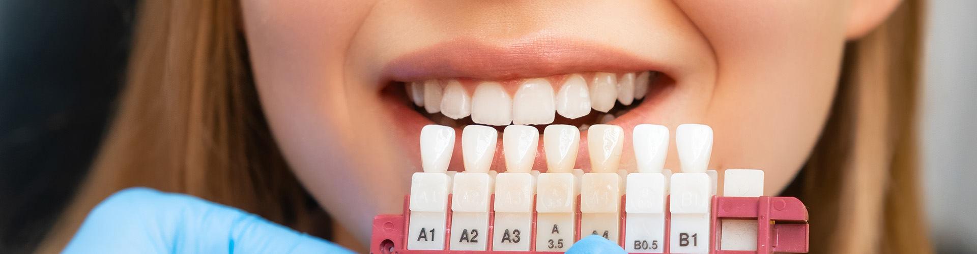gloved hands holding tooth shade-matching tool against woman's teeth