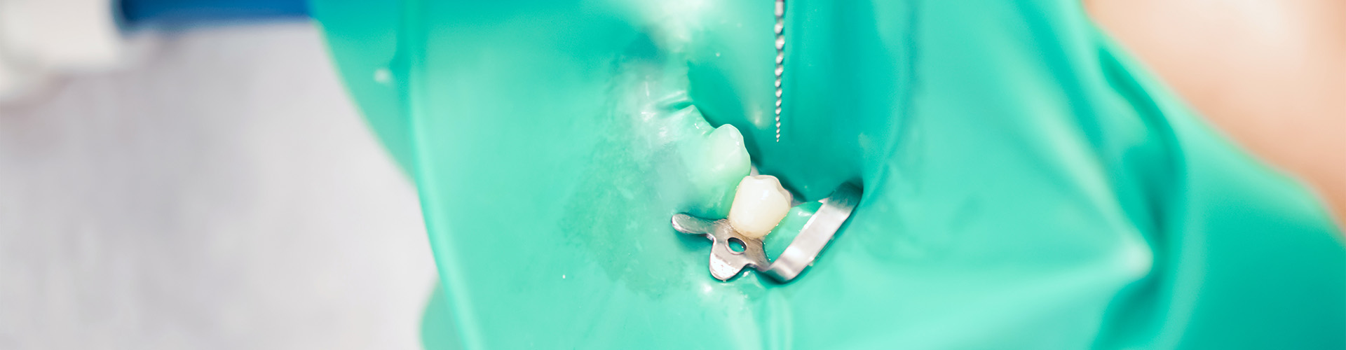 root canal treatment being performed on a patient wearing a dental dam