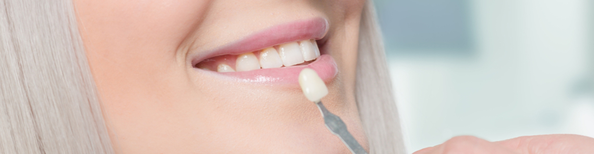 dental veneer being held near woman's smile