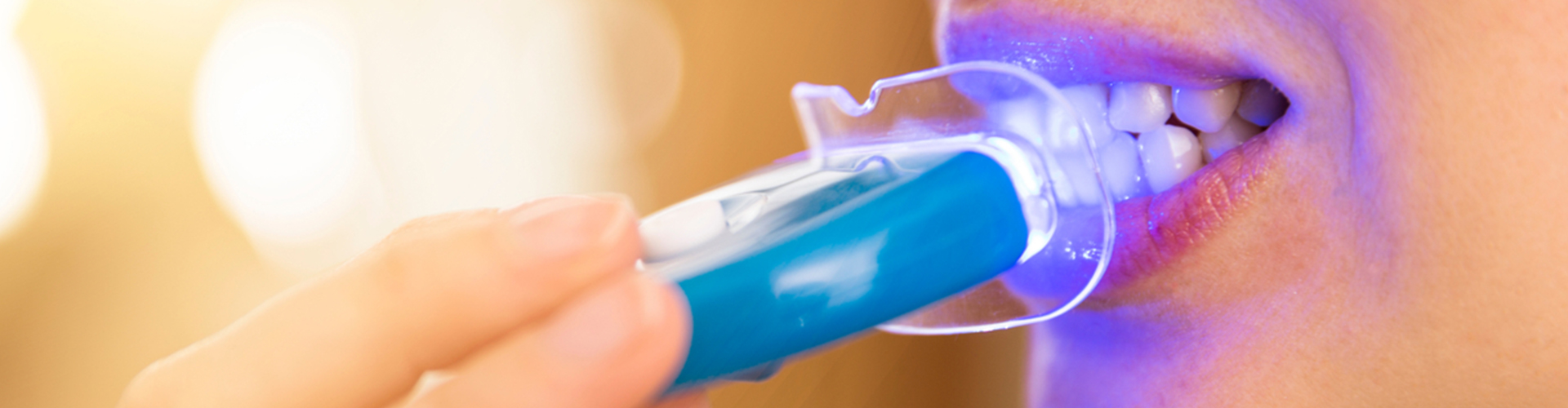 woman having LED light teeth whitening