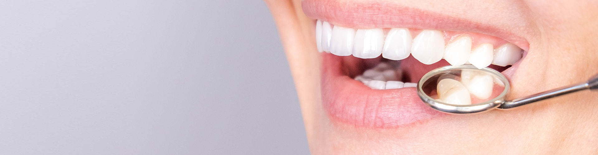 woman smiling with dental mirror between her upper and lower teeth