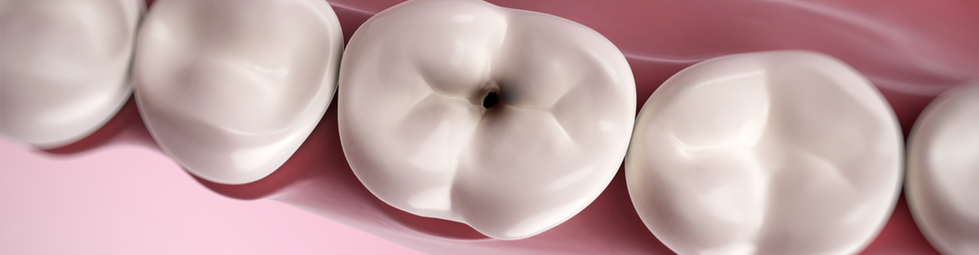 illustration of tooth with black hole