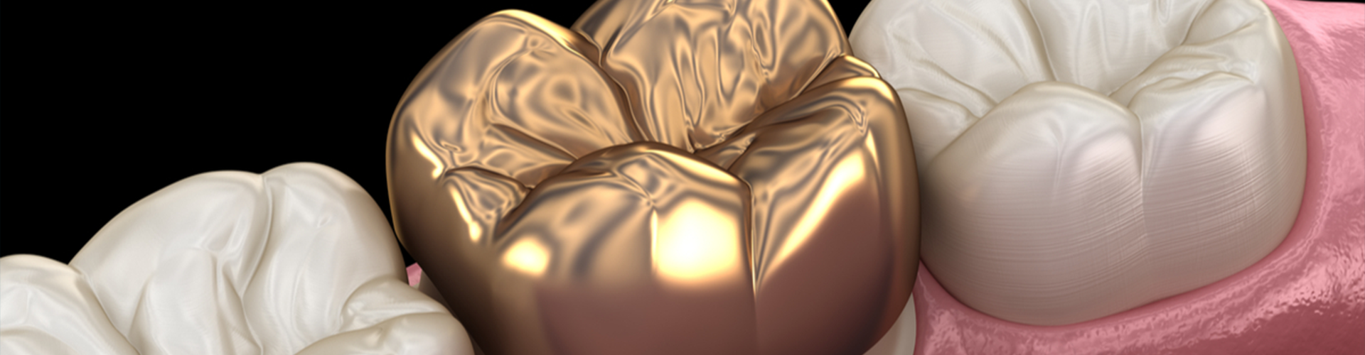 illustration of a gold crown 