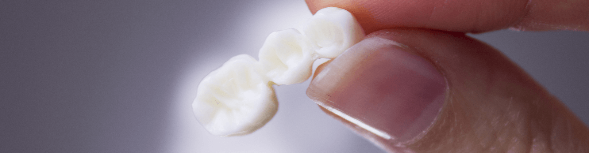 finger and thumb holding dental bridge