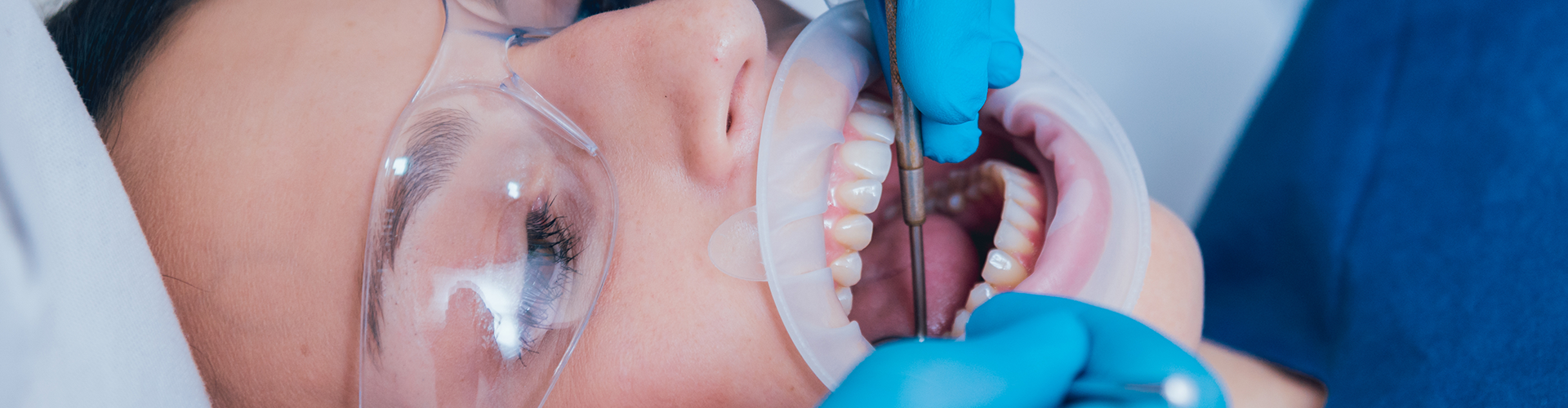 patient wearing glasses and a dental dam with gloved hands peforming a procedure in their mouth