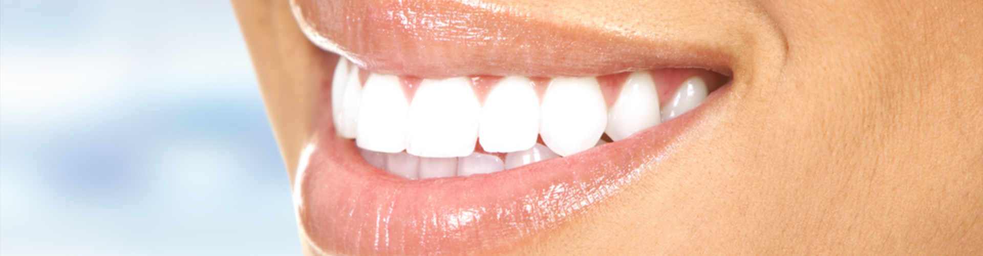 pic of a white and straight smile