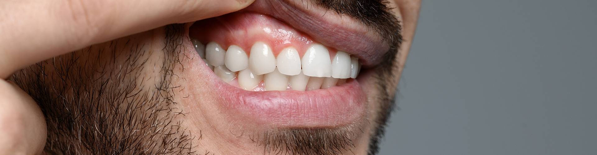 man lifting lip to show inflamed gums