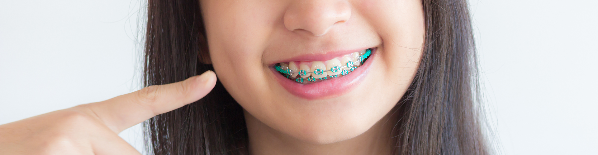 smiling teen with braces pointing at her mouth