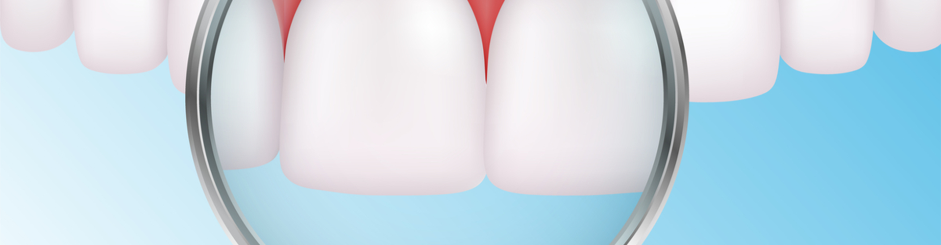 illustration of magnifying glass being held up to two front teeth
